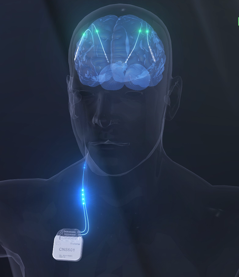 圖片2.png 圖片2.png