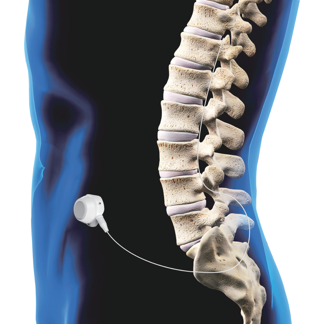 640 (1).png 640 (1).png